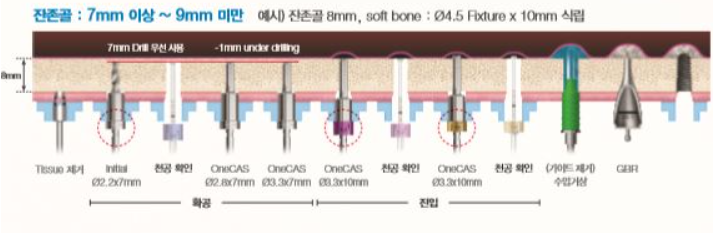 잔존골 7mm이상 9mm미만